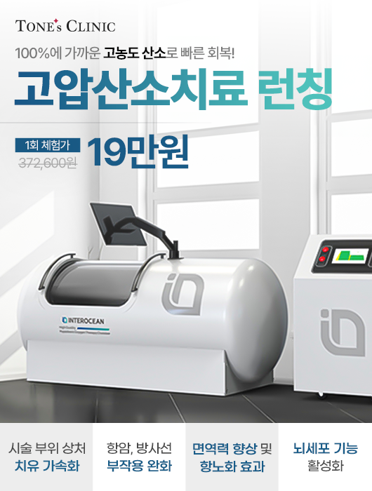 팝업